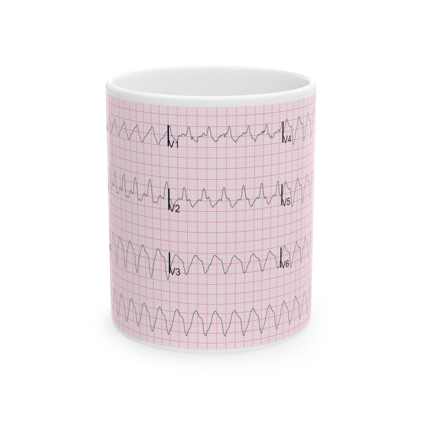 EKG Ceramic Mug 11oz