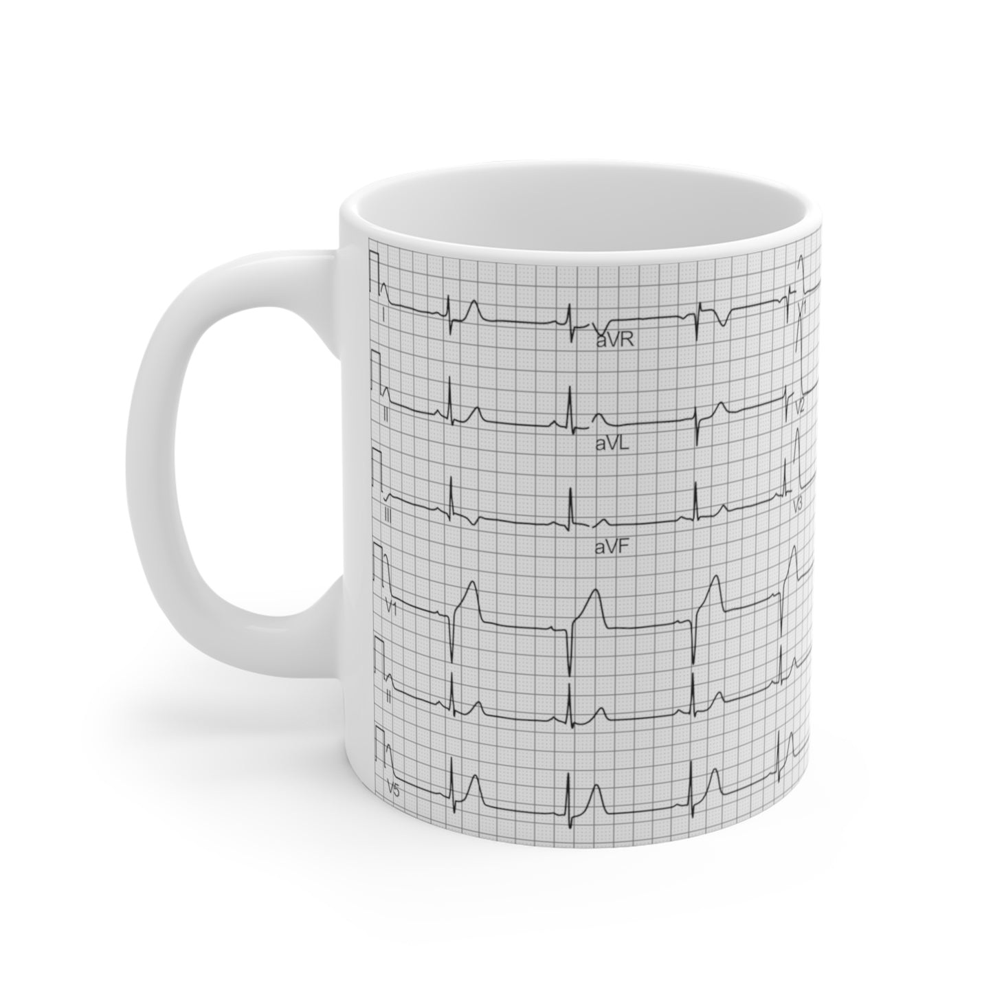 EKG Rhythm Mug 11oz