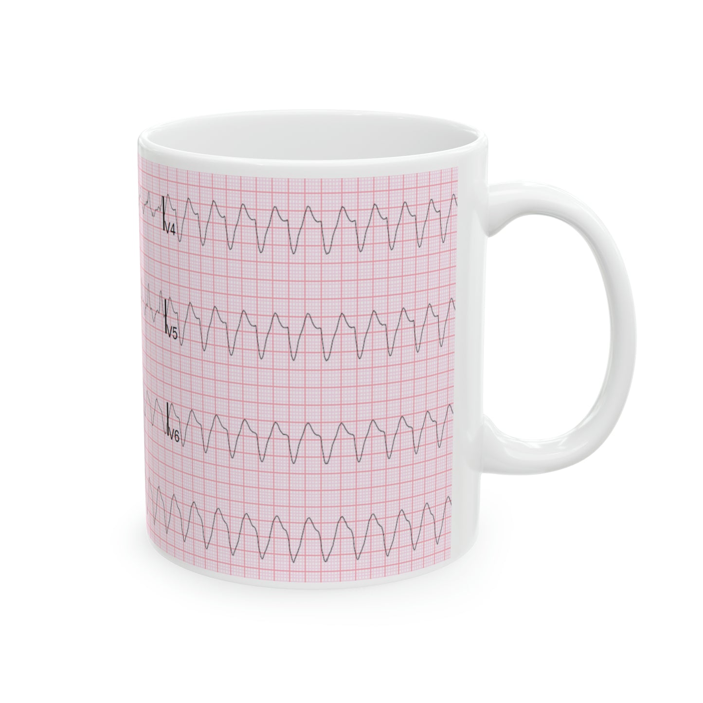 EKG Ceramic Mug 11oz