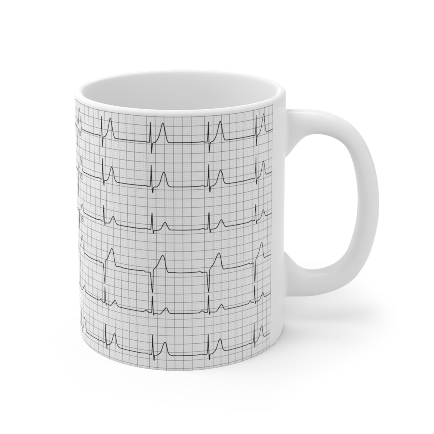 EKG Rhythm Mug 11oz