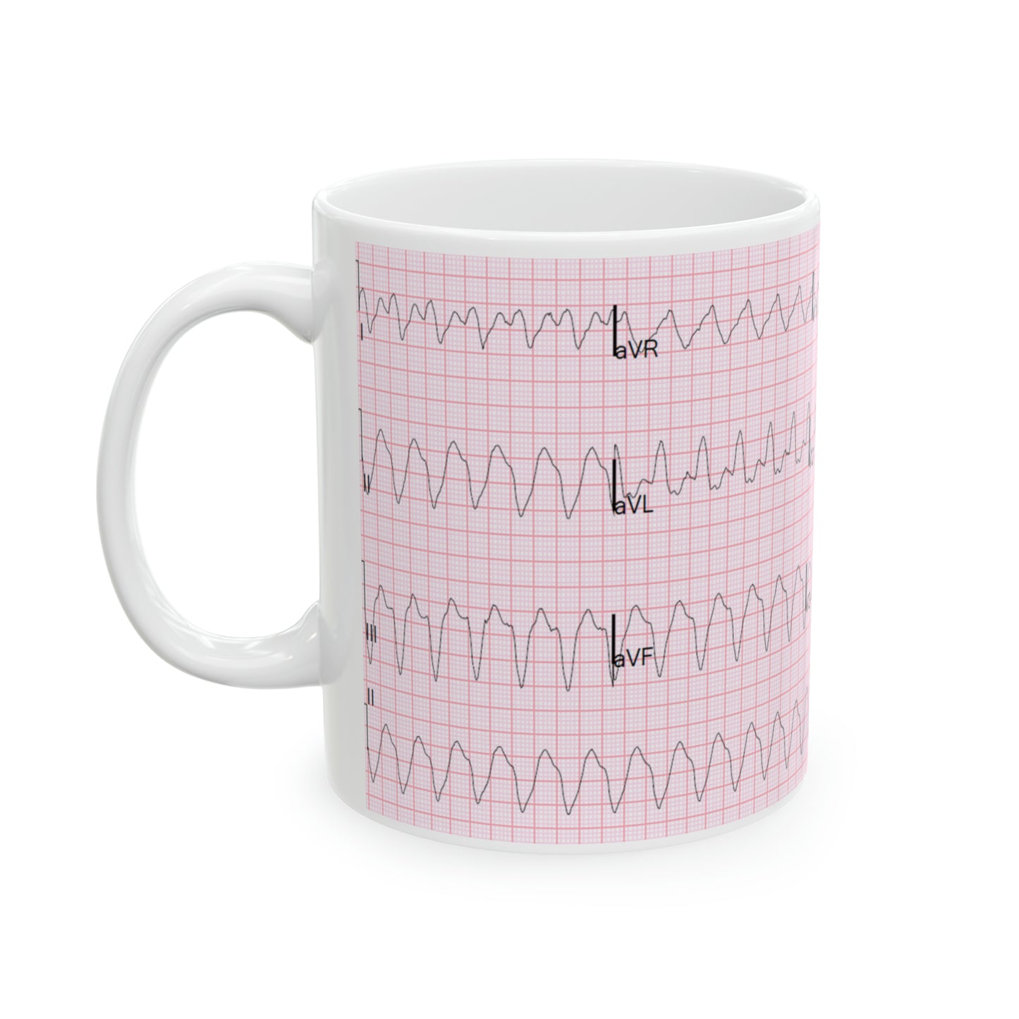 EKG Ceramic Mug 11oz