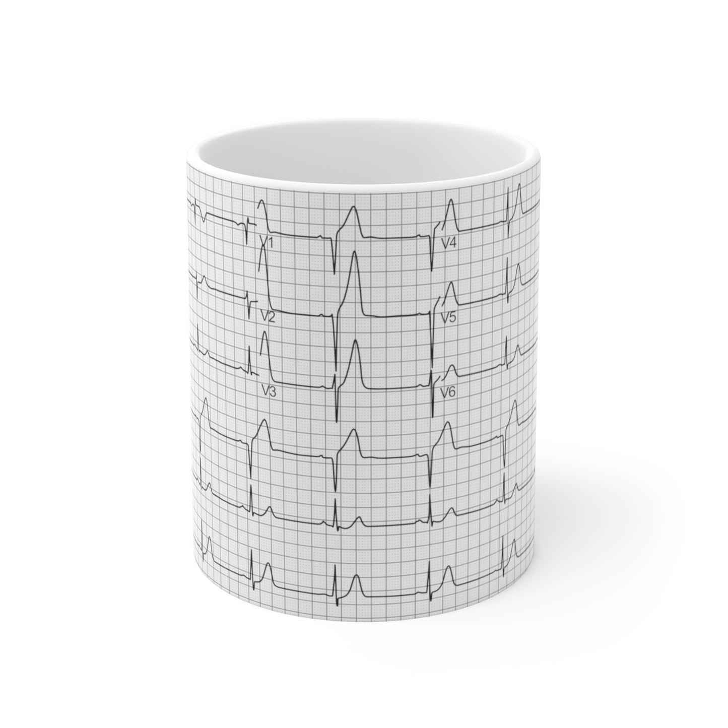 EKG Rhythm Mug 11oz